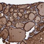 PGLS Antibody in Immunohistochemistry (Paraffin) (IHC (P))