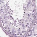 Filensin Antibody in Immunohistochemistry (IHC)