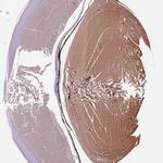 Filensin Antibody in Immunohistochemistry (IHC)