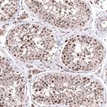 C20orf196 Antibody in Immunohistochemistry (Paraffin) (IHC (P))