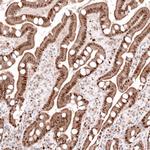 C20orf196 Antibody in Immunohistochemistry (Paraffin) (IHC (P))