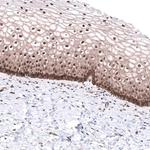 C20orf196 Polyclonal Antibody