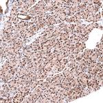 C20orf196 Antibody in Immunohistochemistry (Paraffin) (IHC (P))