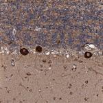 FLYWCH1 Polyclonal Antibody