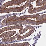 HERPUD1 Antibody in Immunohistochemistry (Paraffin) (IHC (P))