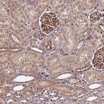 HERPUD1 Antibody in Immunohistochemistry (Paraffin) (IHC (P))