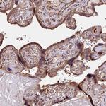 HERPUD1 Antibody in Immunohistochemistry (Paraffin) (IHC (P))