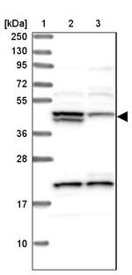 HERPUD1 Antibody in Western Blot (WB)