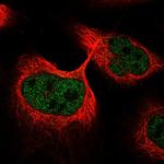 ANKDD1A Polyclonal Antibody