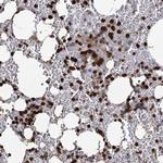 ANKDD1A Antibody in Immunohistochemistry (Paraffin) (IHC (P))