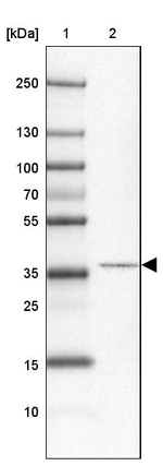 CCDC113 Antibody in Western Blot (WB)