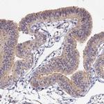 CCDC113 Antibody in Immunohistochemistry (IHC)