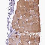 CTDSPL2 Antibody in Immunohistochemistry (Paraffin) (IHC (P))
