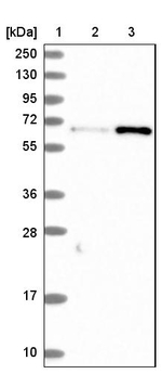 CTDSPL2 Antibody in Western Blot (WB)
