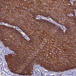 CTDSPL2 Antibody in Immunohistochemistry (IHC)