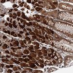 WDR34 Polyclonal Antibody