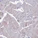 PPIL3 Antibody in Immunohistochemistry (Paraffin) (IHC (P))
