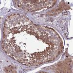 PPIL3 Antibody in Immunohistochemistry (Paraffin) (IHC (P))