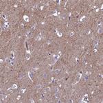 SV2C Antibody in Immunohistochemistry (Paraffin) (IHC (P))