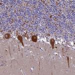 SV2C Antibody in Immunohistochemistry (IHC)