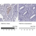 FAM71B Antibody in Immunohistochemistry (IHC)