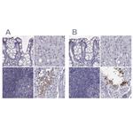FAM71B Polyclonal Antibody