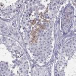 FAM71B Antibody in Immunohistochemistry (IHC)