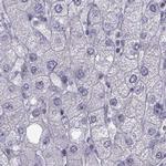 FAM71B Antibody in Immunohistochemistry (IHC)