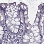 FAM71B Antibody in Immunohistochemistry (IHC)