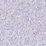 GIF Antibody in Immunohistochemistry (IHC)