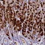 GIF Antibody in Immunohistochemistry (IHC)