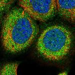 RCCD1 Polyclonal Antibody