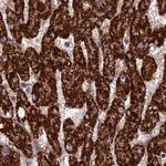 RCCD1 Antibody in Immunohistochemistry (IHC)