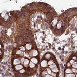 RCCD1 Antibody in Immunohistochemistry (IHC)