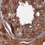 RCCD1 Antibody in Immunohistochemistry (IHC)