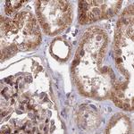 RCCD1 Antibody in Immunohistochemistry (IHC)