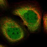 RNH1 Polyclonal Antibody