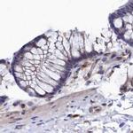 RNH1 Antibody in Immunohistochemistry (IHC)