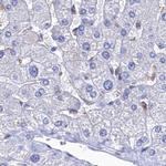 RNH1 Antibody in Immunohistochemistry (IHC)