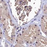 RNH1 Antibody in Immunohistochemistry (IHC)