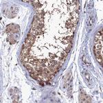 RNH1 Antibody in Immunohistochemistry (IHC)