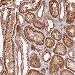 LRRC28 Polyclonal Antibody