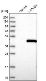 LRRC28 Antibody in Western Blot (WB)