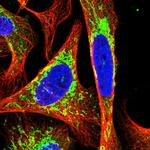 DLAT Polyclonal Antibody