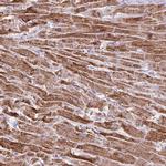 DLAT Antibody in Immunohistochemistry (IHC)