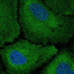CDAN1 Polyclonal Antibody