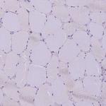 CDAN1 Antibody in Immunohistochemistry (Paraffin) (IHC (P))