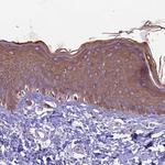 CDAN1 Antibody in Immunohistochemistry (Paraffin) (IHC (P))