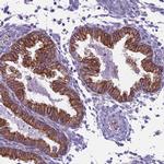 CDAN1 Antibody in Immunohistochemistry (IHC)