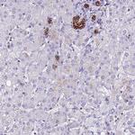 CDAN1 Antibody in Immunohistochemistry (IHC)